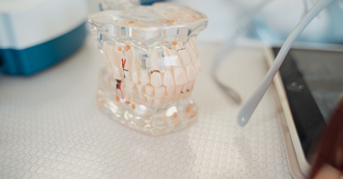 Close-up of a dental model on a clinic table, showcasing teeth anatomy.